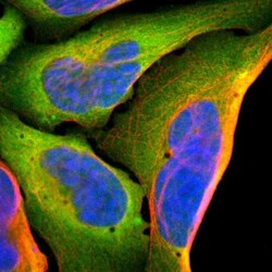 AHSA1 Antibody, Novus Biologicals 25 &mu;L; Unlabeled:Antibodies, Polyclonal